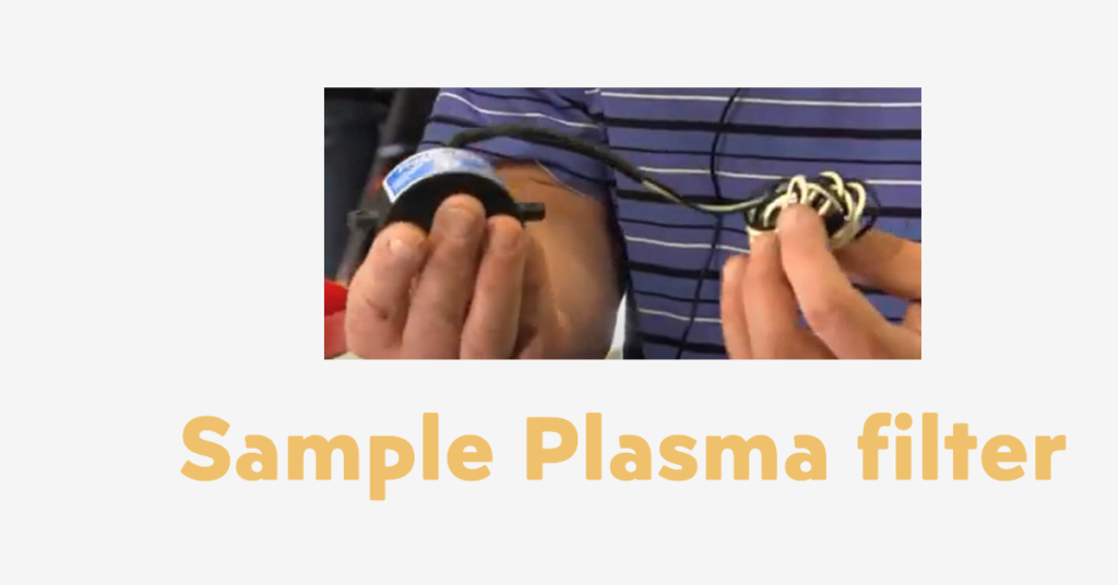 plasma filter